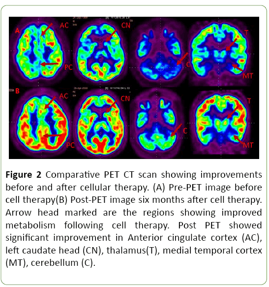 neuropsychiatry-Comparative-PET