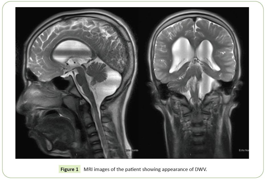 neuropsychiatry